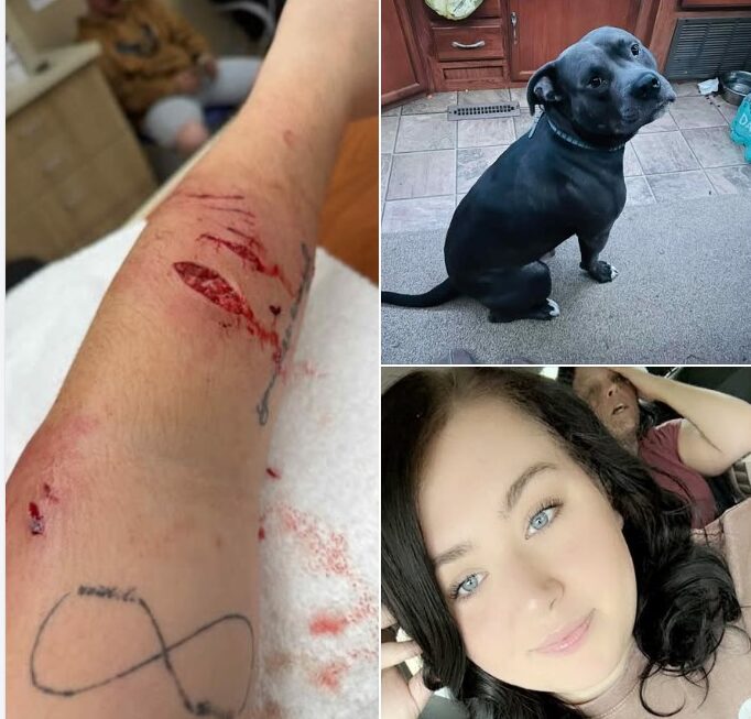 Jadyn Langley 20-Year-Old Mauled by Neighbor’s Pit Bull in Vicious Attack Fueled by Eviction Rage. Nerve Damage Suffered